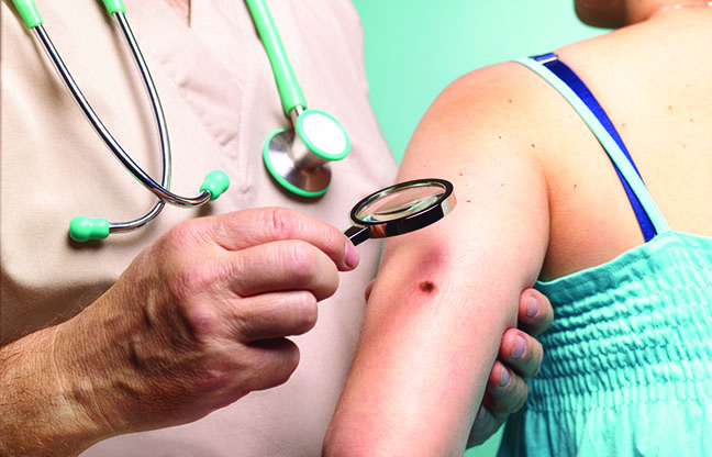 Types of skin cancer and how to spot them